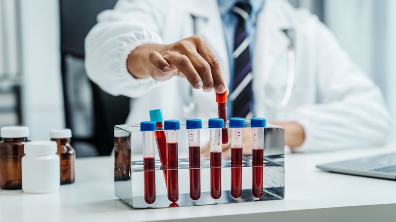 Illustration d'un test sanguin