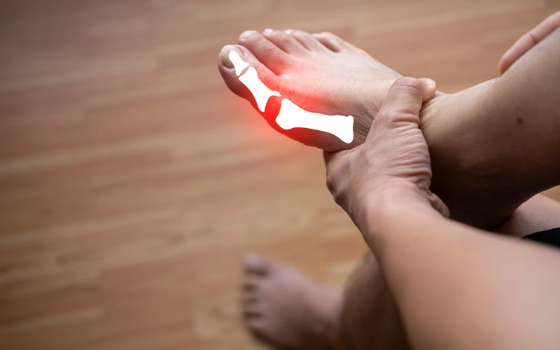 J'ai trop d'acide urique, c'est grave?