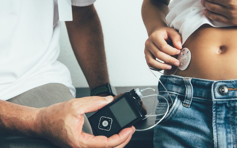 Comment fonctionne la pompe à insuline connectée, ce traitement innovant pour mieux gérer son diabète?